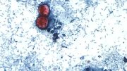 bacteria cyclosporiasis bajo microscopio