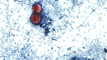 bacteria cyclosporiasis bajo microscopio