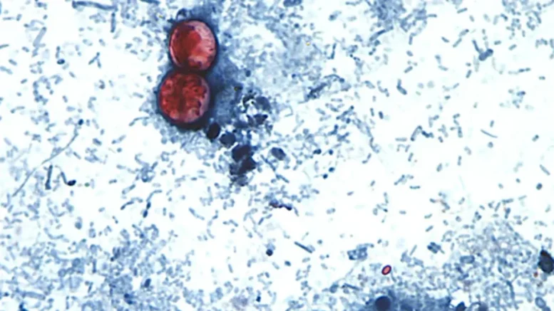 bacteria cyclosporiasis bajo microscopio